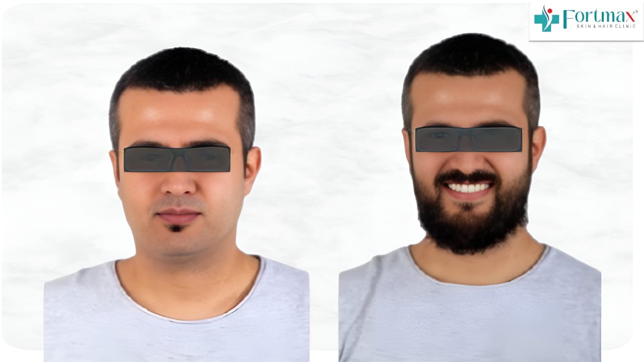 Before and After Result 3