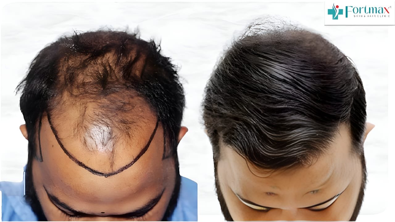 Before and After Result 4