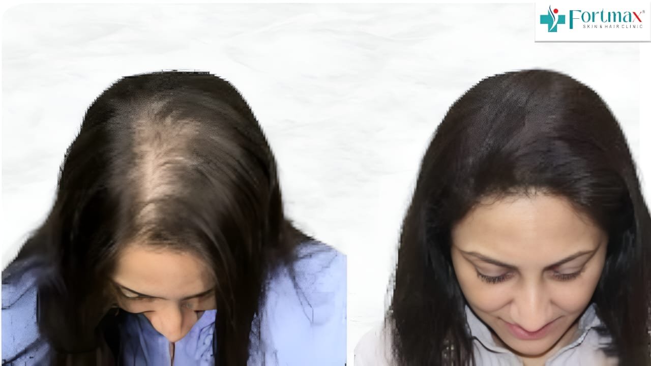 Before and After Result 2