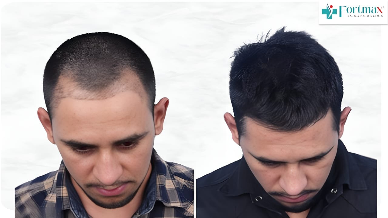 Before and After Result 6