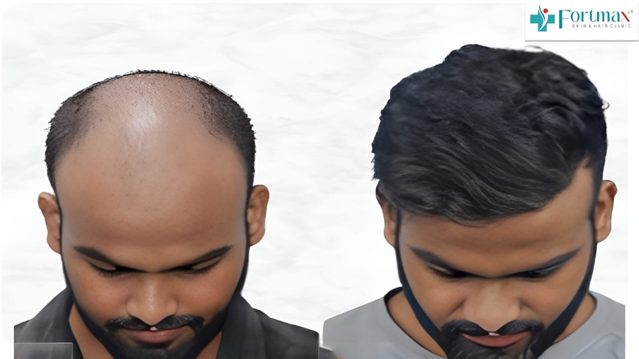 Before and After Result 1
